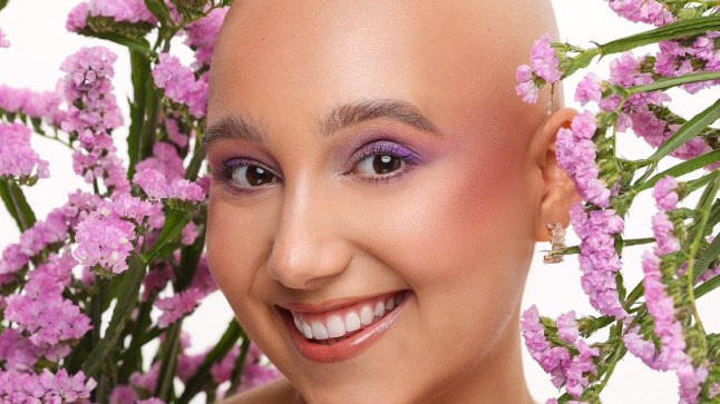 Amy Chilton: It started with itchy skin. X months later, I was diagnosed with lymphoma at 23
