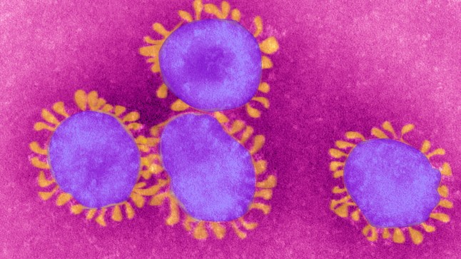 List of viruses that pose biggest threat to public health released